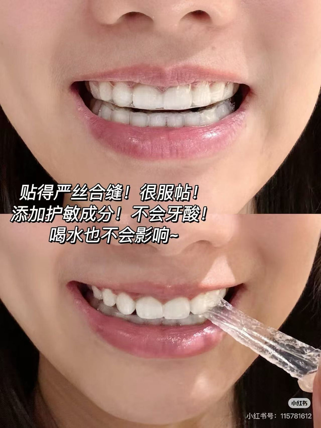 美白牙贴 14对